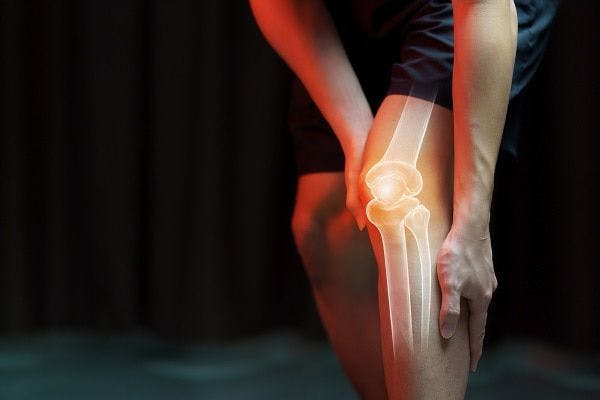 X-ray image of joint pain and inflammation of someone's knee. 